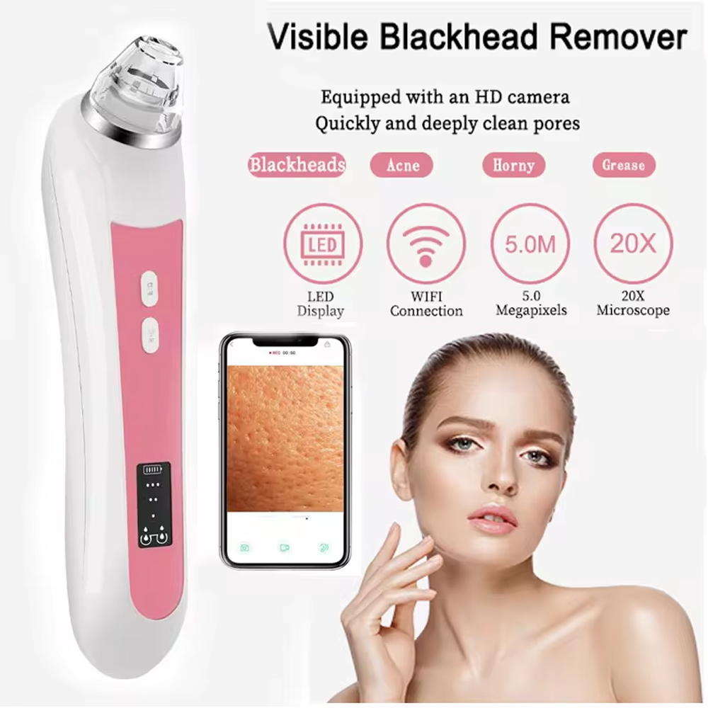 Aspirapolvere per la rimozione - Nasal Aspirator recensione e prezzo